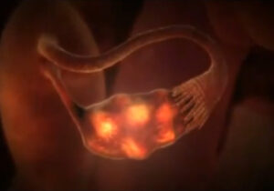 video-pic-3