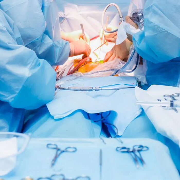 laparoscopy